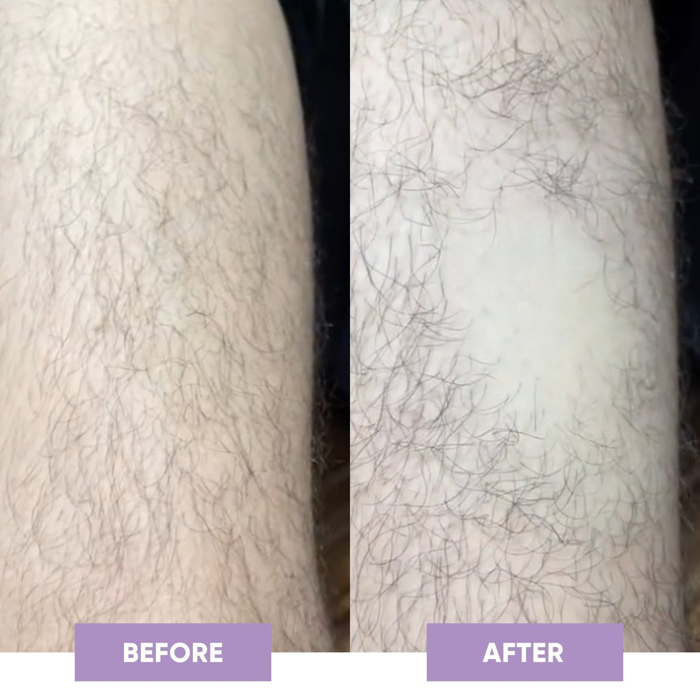 SilkSkin Haarverwijderaar - Novoza