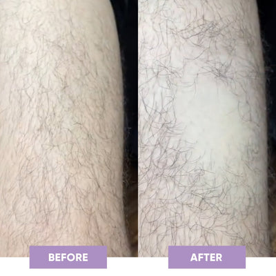 SilkSkin Haarverwijderaar - Novoza