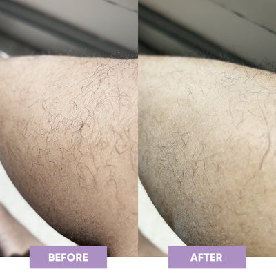 SilkSkin Haarverwijderaar - Novoza