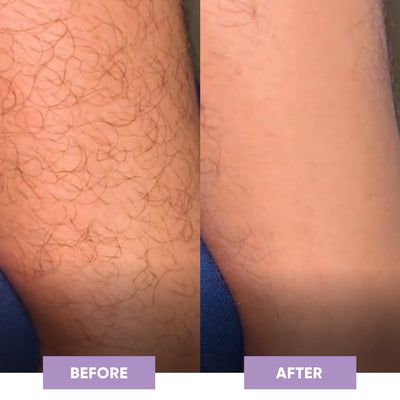 SilkSkin Haarverwijderaar - Novoza