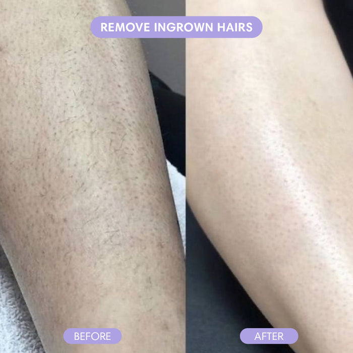 SilkSkin Haarverwijderaar - Novoza