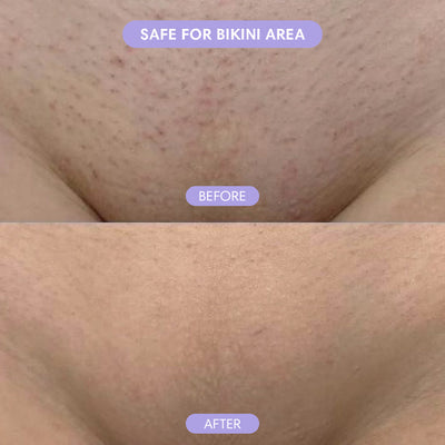 SilkSkin Haarverwijderaar - Novoza