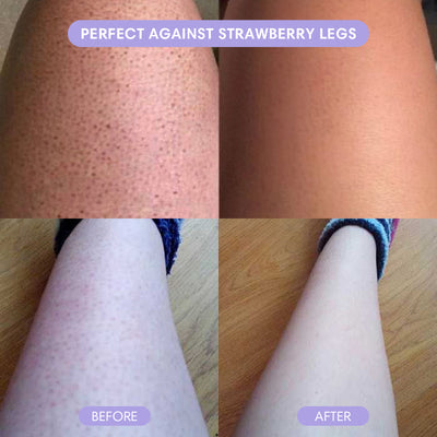 SilkSkin Haarverwijderaar - Novoza